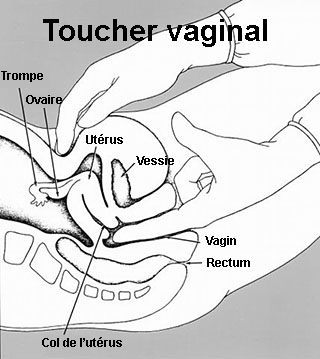 Le Toucher Vaginal Doit Il Etre Systematique Oummi Materne Le Blog Des Mamans